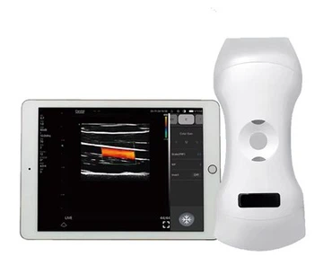 Mini Handheld Ultratovound mashinasi